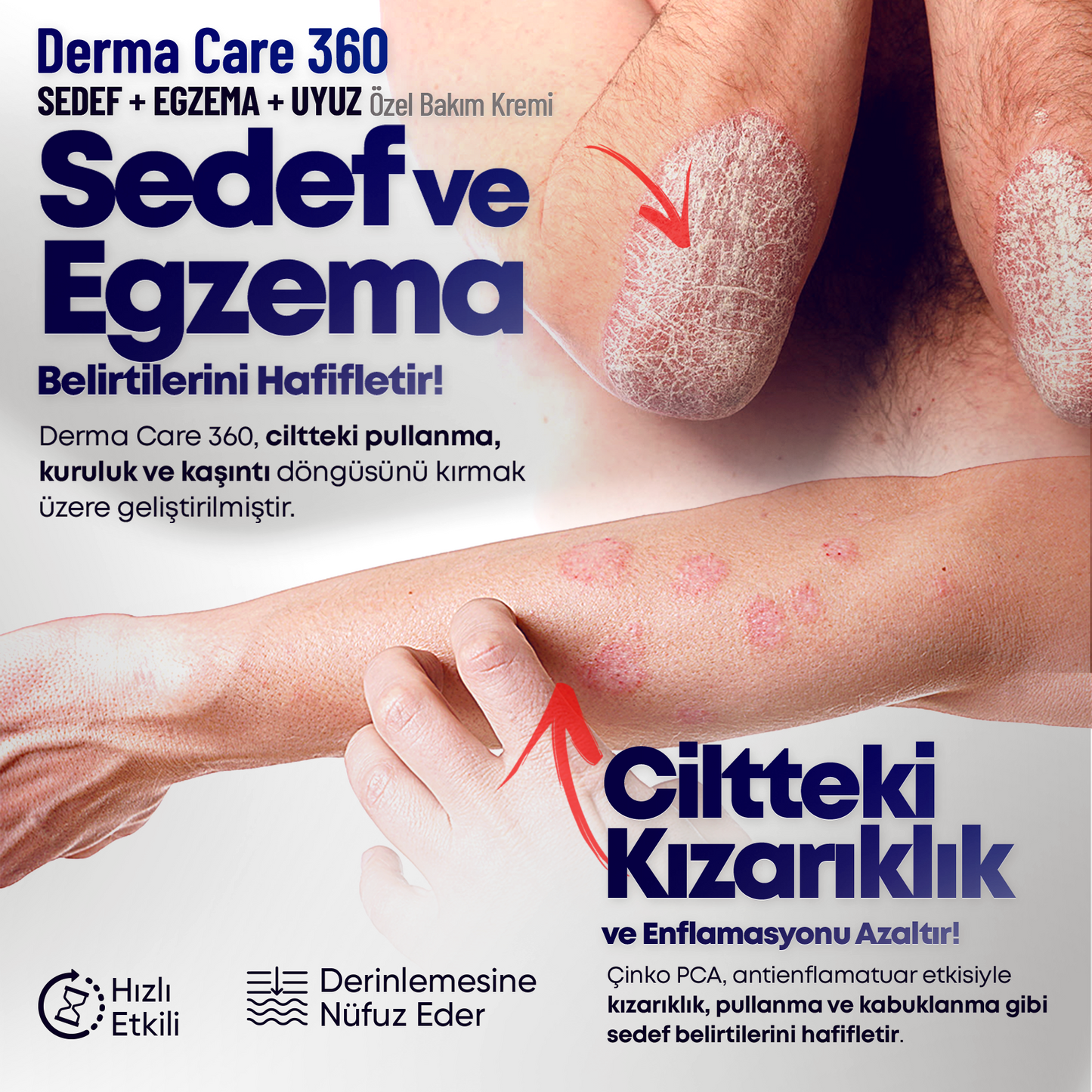 Derma Care 360 - Sedef, Egzema ve Cilt Problemlerine Özel Bakım Kremi 120Ml