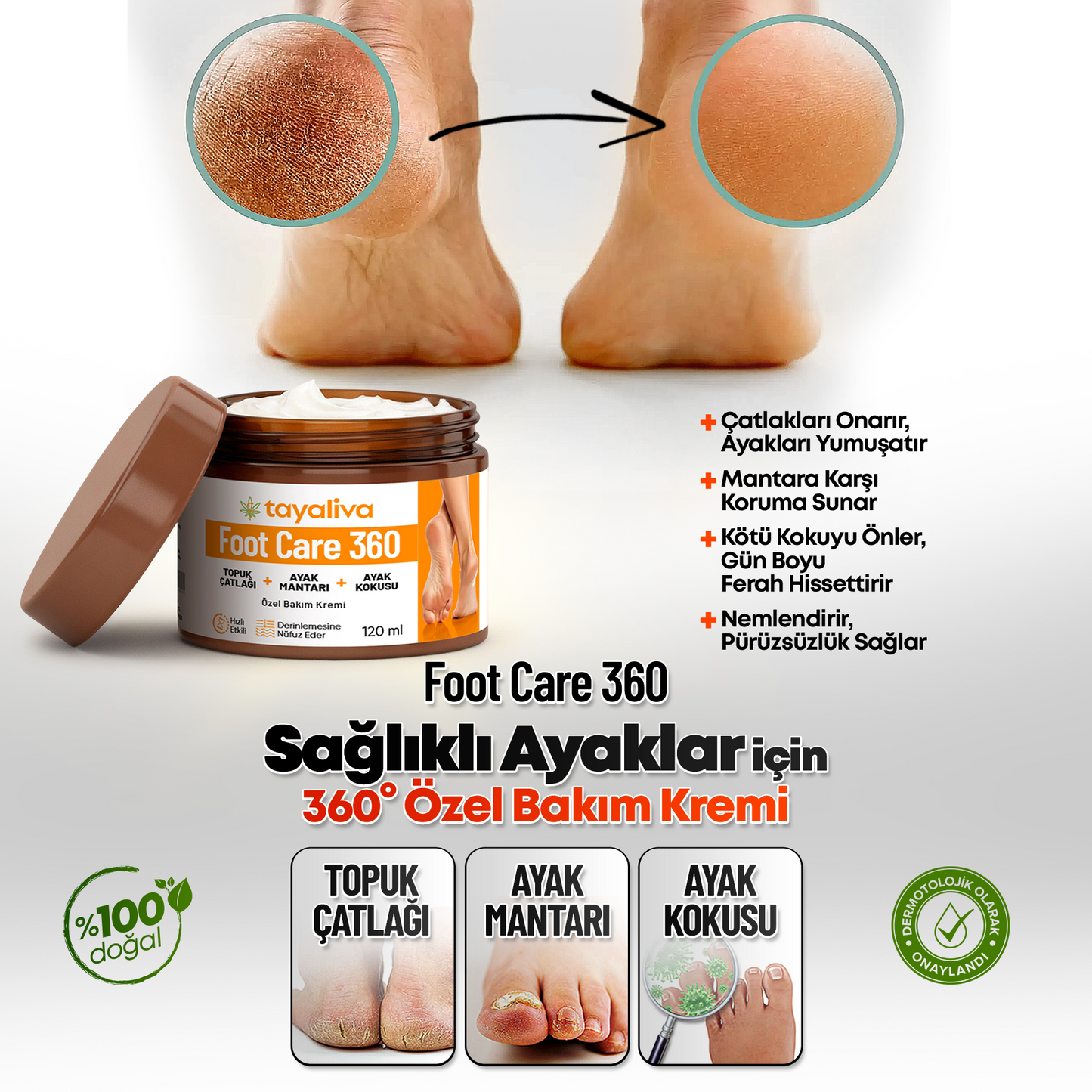 Foot Care 360 - Çatlaklar,Kötü Koku,Mantar ve Siğillere Karşı Özel Bakım Kremi 120ml