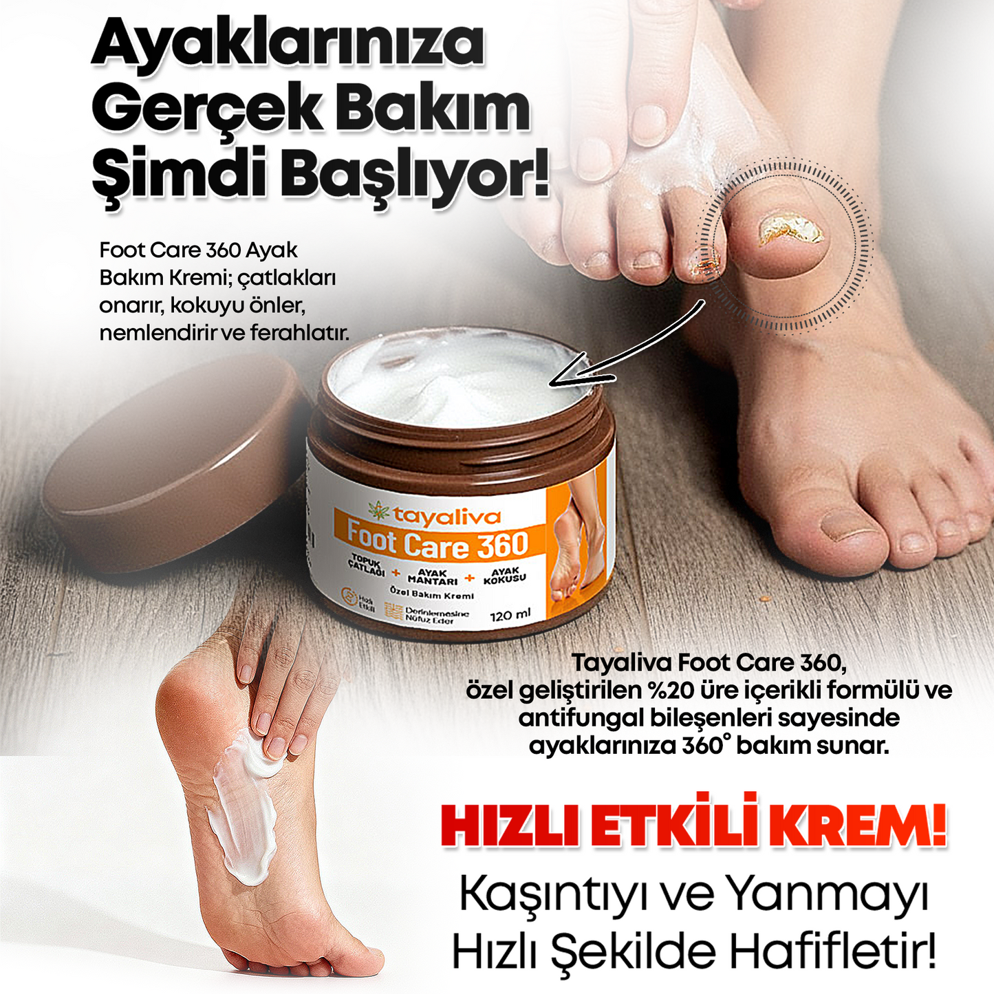 Foot Care 360 - Çatlaklar,Kötü Koku,Mantar ve Siğillere Karşı Özel Bakım Kremi 120ml